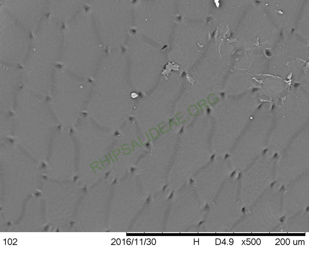 Rhipsalis aurea, AH 676, Nova Friburgo, Rio de Janeiro, Brazil, SEM of seed