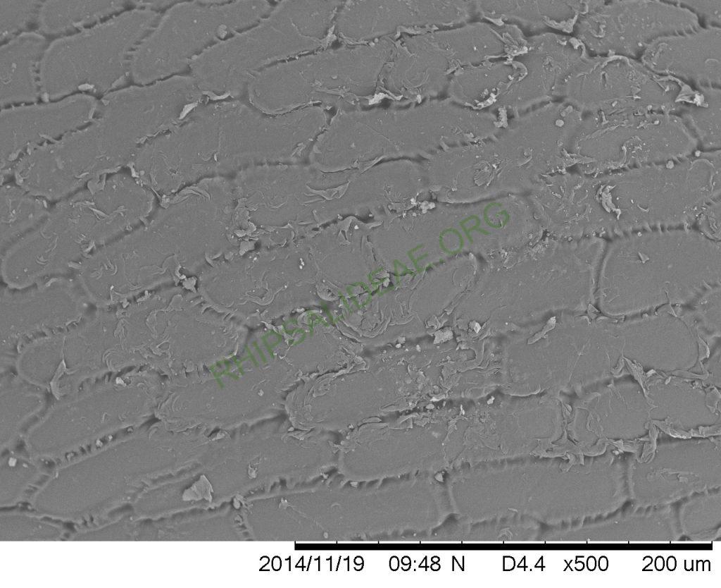 Rhipsalis flagelliformis, GO 457, SEM of seed